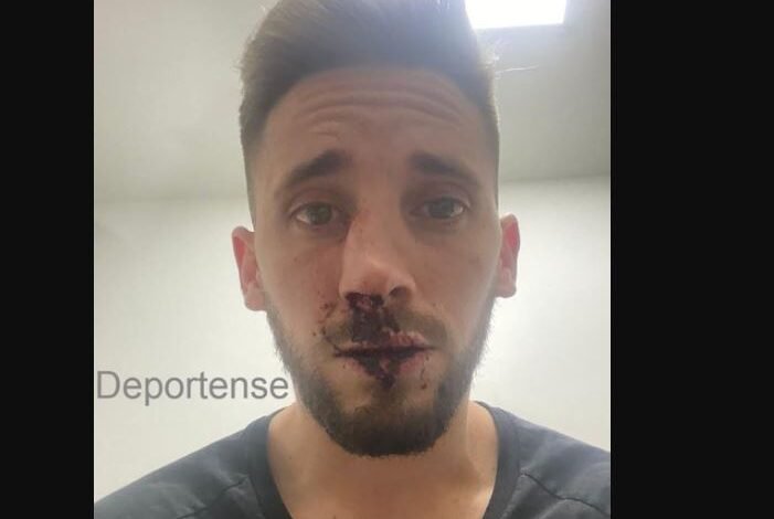 ¡Vergonzoso! Gravísima agesión a un futbolista de Platense por parte de hinchas de Estudiantes de Caseros